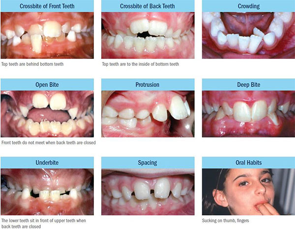 common orthodontic problems