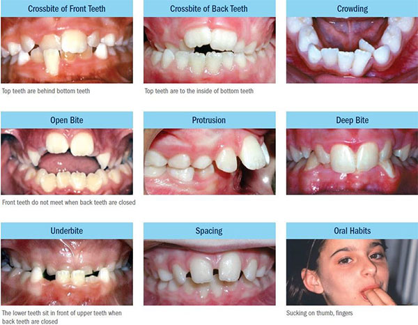 common orthodontic problems common orthodontic problems