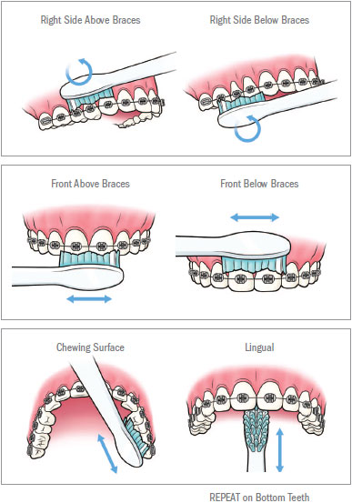 how-to-brush-diagram