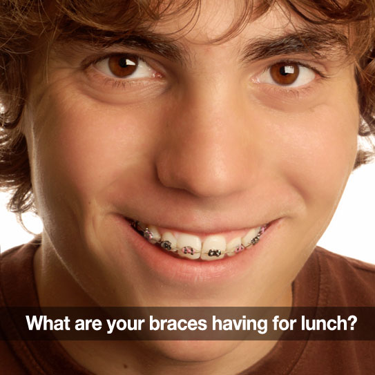 braces friendly lunches