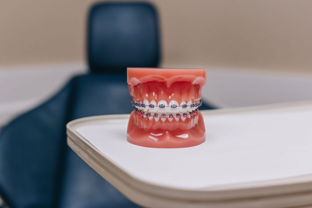 orthodontist nj reviews