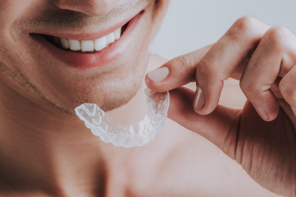 retainer for mouth
