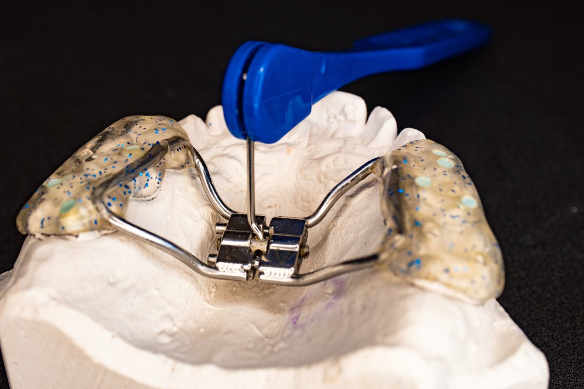 https://www.bordentownbraces.com/wp-content/uploads/2023/08/palate-expander-1200x800.jpg