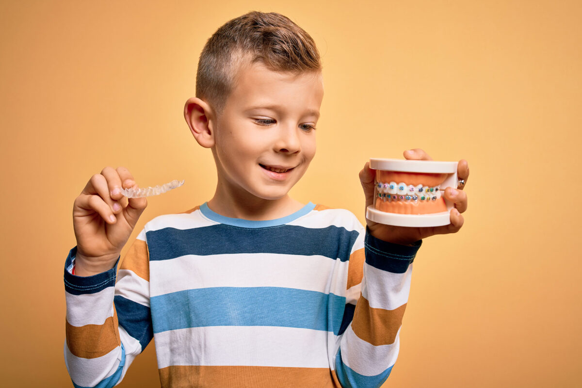 clear aligners vs braces