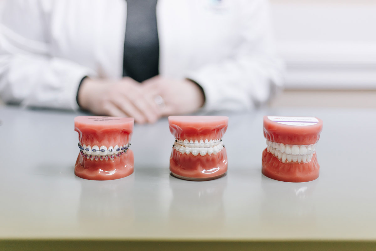 Straight Teeth